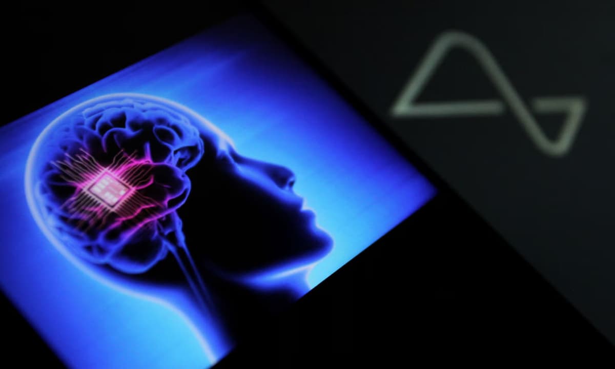 Britaniyada kayfiyatni yaxshilashga yordam beradigan miya implantati yaratildi