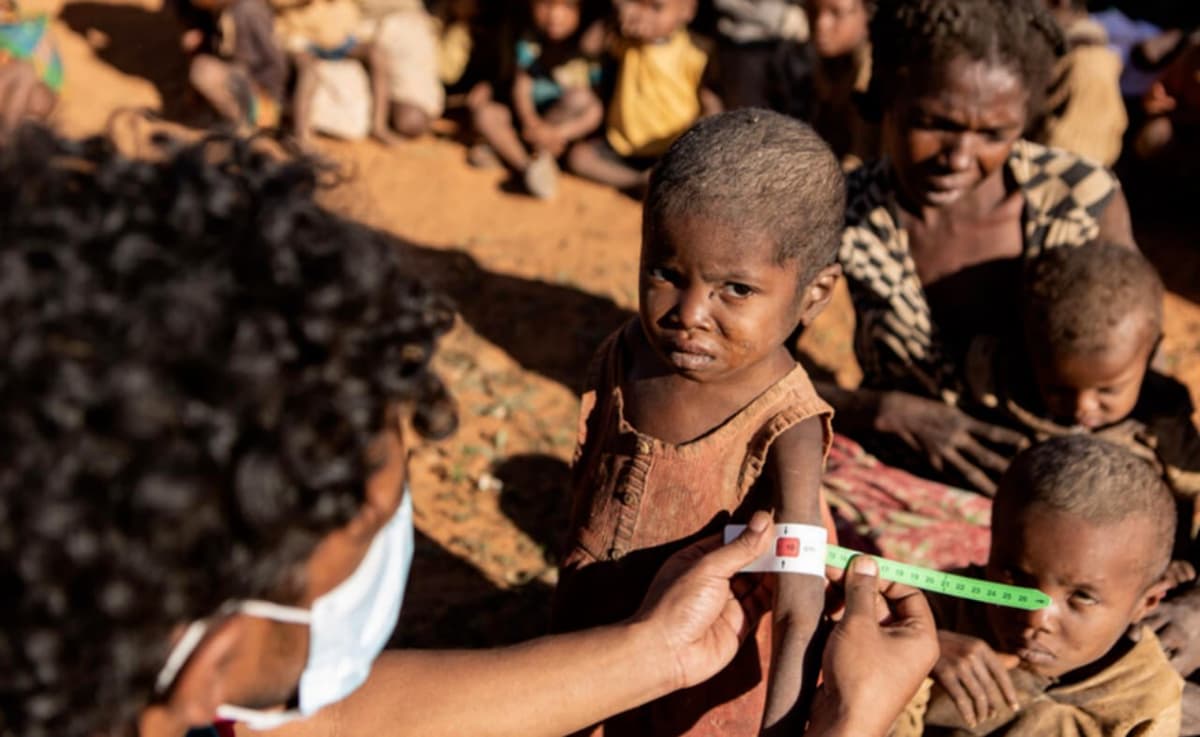 BMT: Afrikada har 6 soniyada ochlikdan bir bola vafot etmoqda