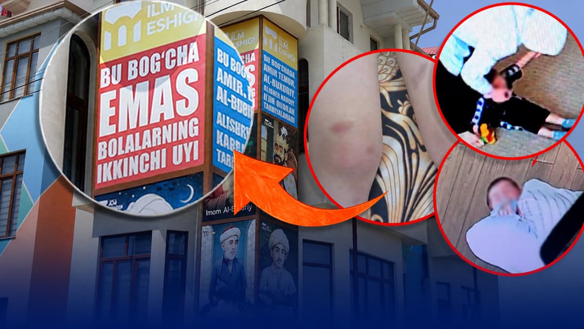 “Hatto igna sanchib qiynashgan”: Toshkentdagi bog‘chada nimalar sodir bo‘ldi?