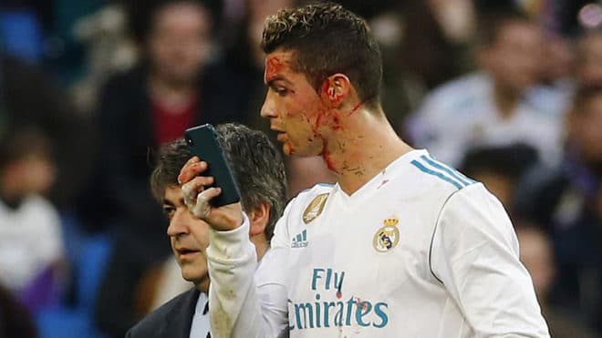 Video: Ronaldu o‘yin vaqtida telefon orqali yuzining ahvolini ko‘rib ranjidi