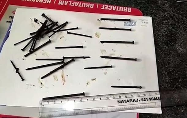 Erkak 116 ta mixni qanday yutib yuborganini eslay olmadi