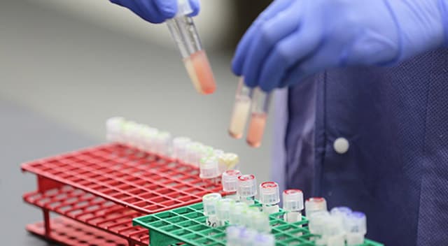O‘zbekiston Rossiya va AQShdan 7500ta koronavirus test tizimlarini sotib olmoqda