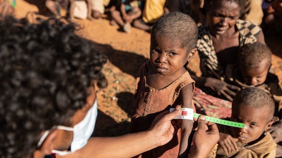 BMT Madagaskardagi ocharchilik haqida ma'lum qildi