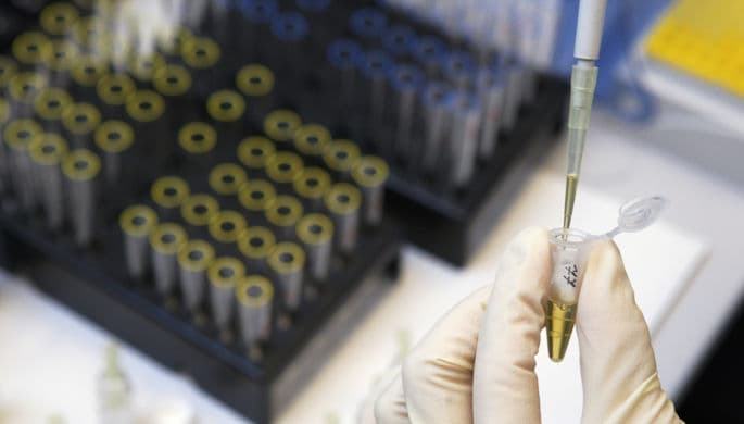 Manba: xitoylik sportchilar ommaviy ravishda doping qo‘llashgan