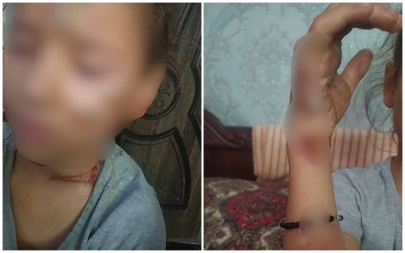 Shofirkonda 9 yoshli qiziga jarohat yetkazgan onaga jinoyat ishi qo‘zg‘atildi