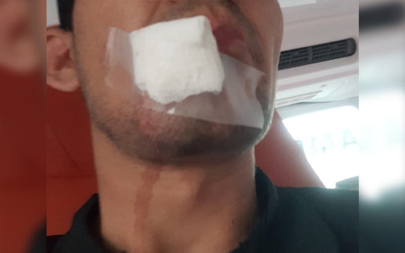 Toshkent tumanida tez yordam shifokori kaltaklandi