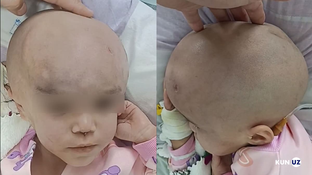 Farg‘onada bolaning hayotini xavf ostida qoldirgan enaga ustidan jinoyat ishi qo‘zg‘atildi
