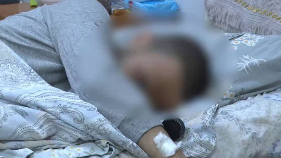 Toshkentda 24 yoshli yigit pirotexnika portlashi tufayli og‘ir jarohat oldi