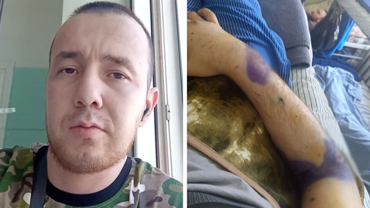«Tanamda 20 tacha oskolka bor» – Rossiyada majburan urushga yuborilgan o‘zbekistonlik hikoyasi