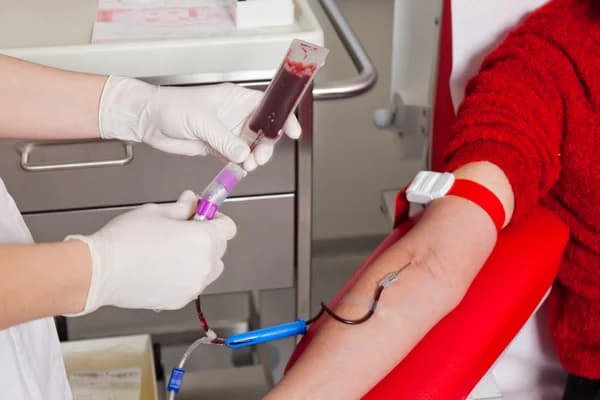 Autodonorlik tartibi tasdiqlandi: donor qoni zaruratda donorning o‘ziga ishlatiladi
