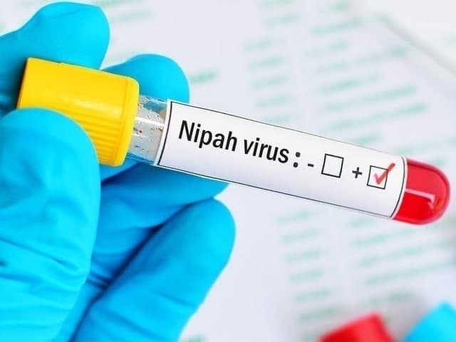Nipah virusi O‘zbekistonda qayd etilmadi – Sanepidqo‘mita