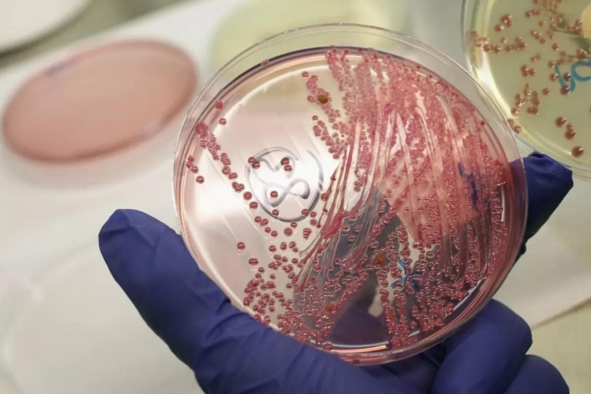 Davlat sanitariya-epidemiologiya nazorati markazi kuydirgi kasalligi haqida eslatma bilan chiqdi