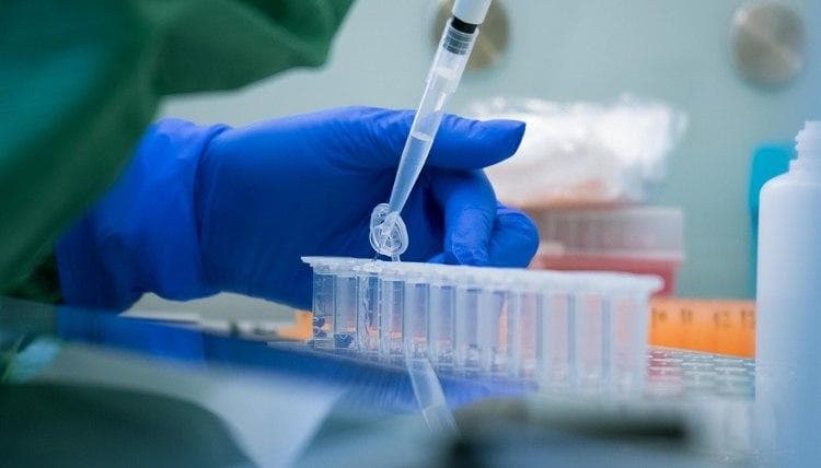 Antitanachalarni aniqlash uchun qaysi test eng informativ hisoblanadi? – shtab a'zosi javob berdi