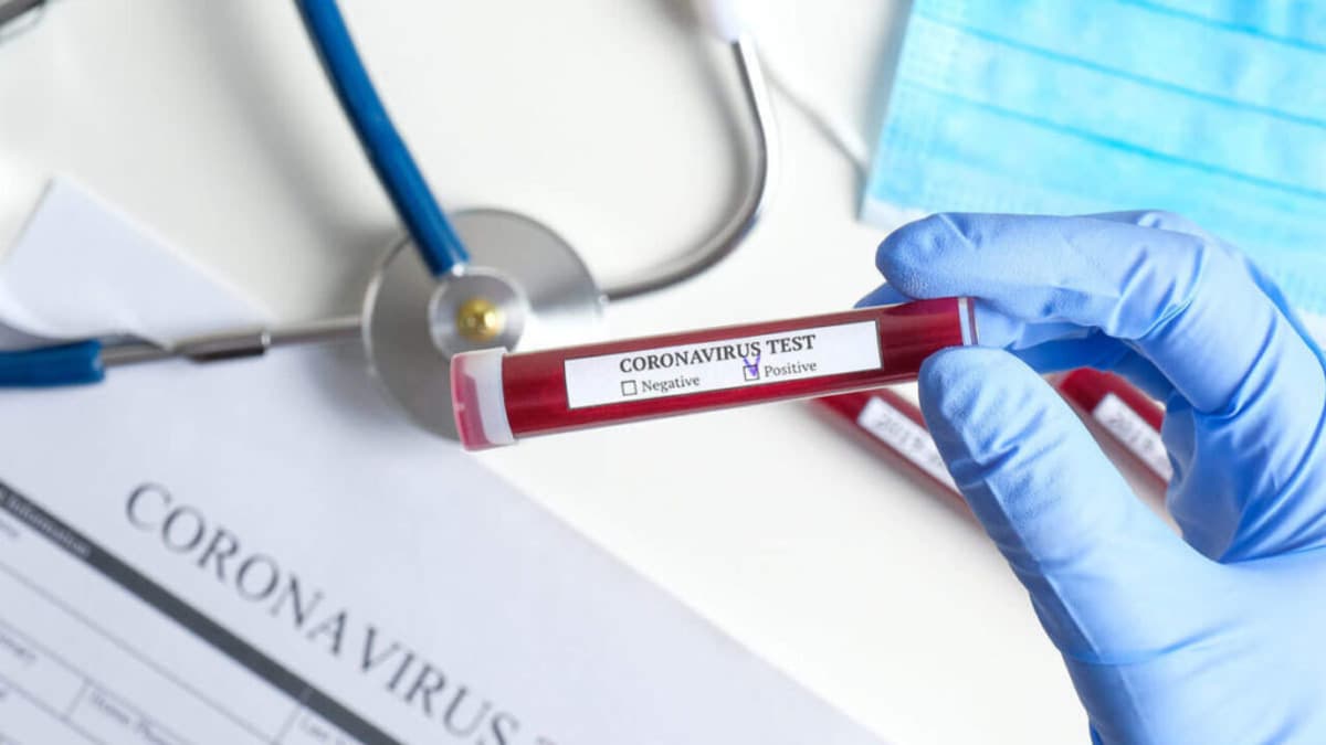 COVID-19dan davolash standartlarini buzgan xususiy klinikalar litsenziyasi bekor qilinadi - vazirlik