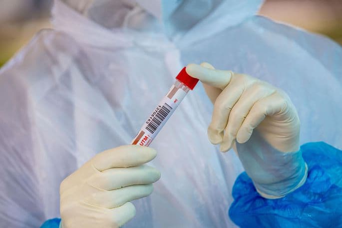 «Davergeodezkadastr» qo‘mitasining 6 nafar xodimida koronavirus aniqlandi