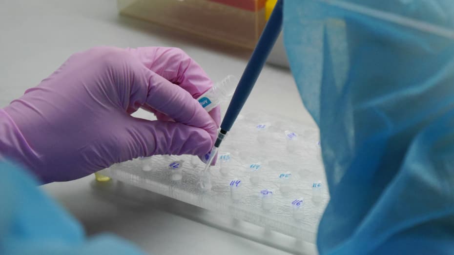 «Xususiy laboratoriyalarda test olish taqiqlangani yo‘q» – Oqilov