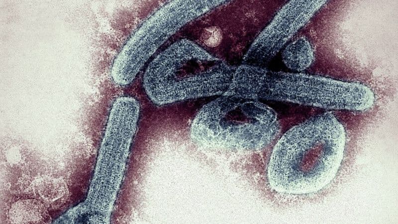 Ebolaga o‘xshash. Gvineyada yana bir o‘limvor virus paydo bo‘ldi