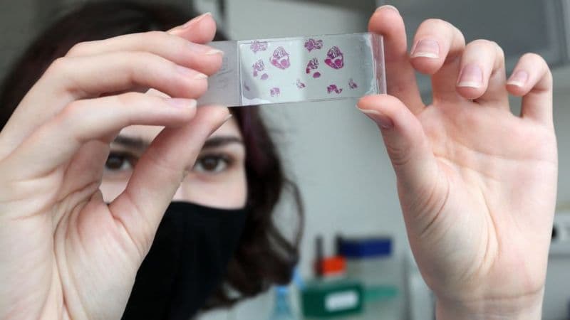 Олимлар коронавирусни бошдан кечирганларда умрбод иммунитет шаклланиши мумкинлигини айтишмоқда