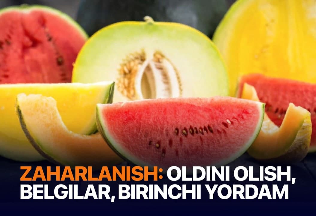 Qovun-tarvuzdan zaharlanmaslik uchun nima qilish kerak? Mutaxassis tavsiyalari