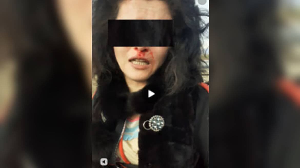 Surxondaryoda ayol kishi «samosud» qilingani videosi tarqaldi. Holat yuzasidan jinoyat ishi qo‘zg‘atildi