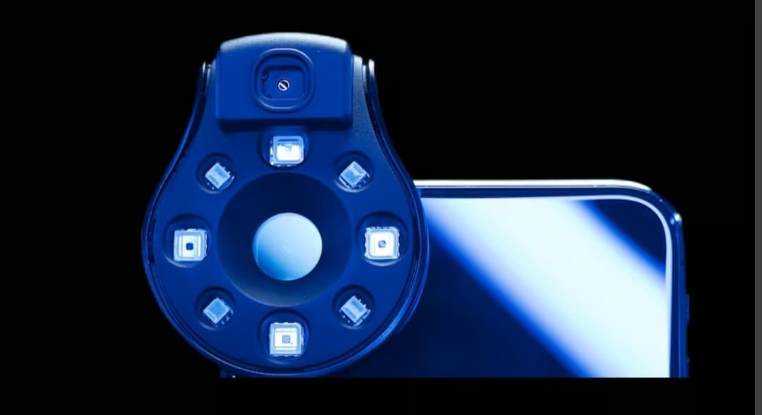 Yaraga tushgan infeksiyani aniqlaydigan telefon kamerasi taqdim qilindi