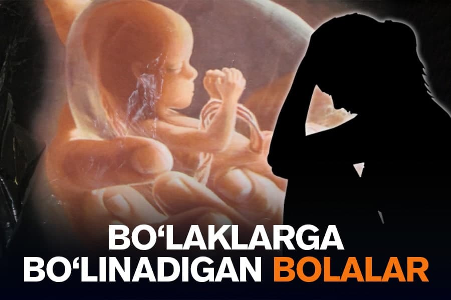 “Abortlarning katta qismi bolaning jinsi qiz bo‘lgani uchun qilinadi” - shifokor hikoyasi