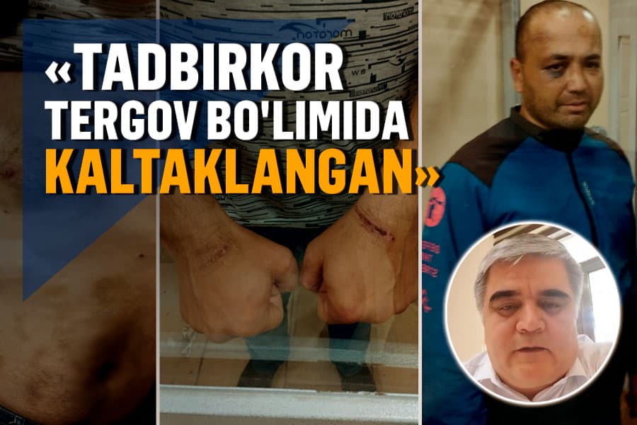 Investor qiynoqqa solingani aytilyapti. Uning advokati IIVning da’vosini rad etdi